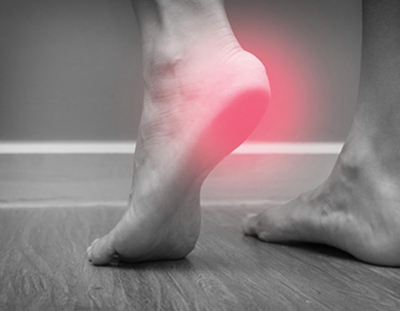 What are the Causes of Plantar Fasciitis?