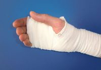 hand injury relief