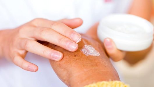 arthritis-cream-application-1024x536.jpg
