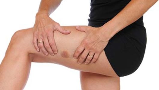 bruise-leg-preview.jpg
