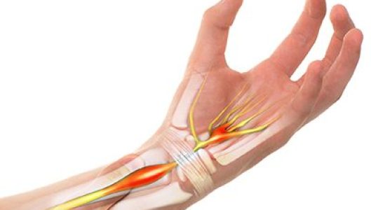 carpel-tunnel-syndrome.jpg